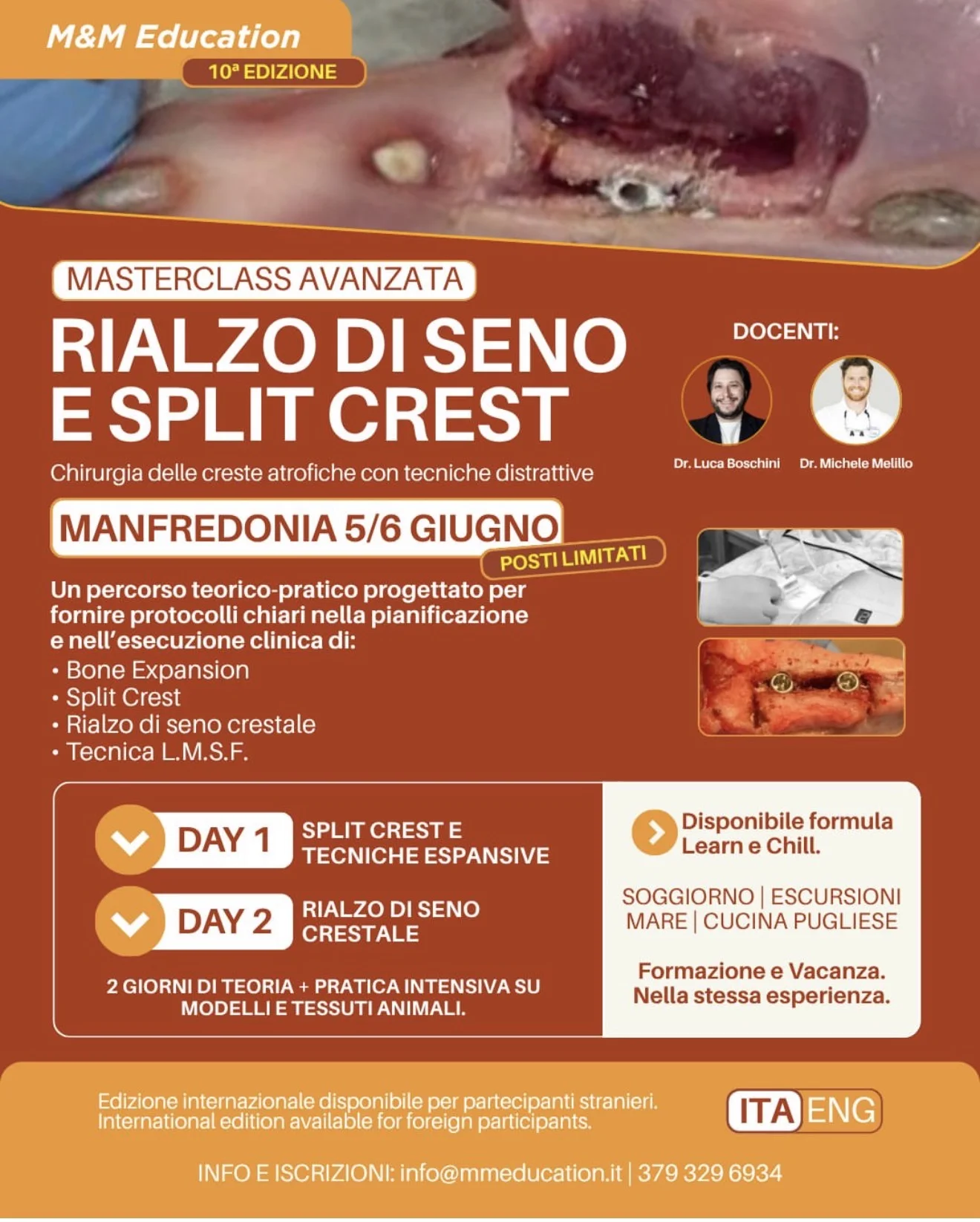 Locandina Masterclass Split Crest e Rialzo di Seno Crestale — Dr. Boschini, Dr. Melillo, Manfredonia 5-6 giugno 2026, M&M Education 10ª edizione