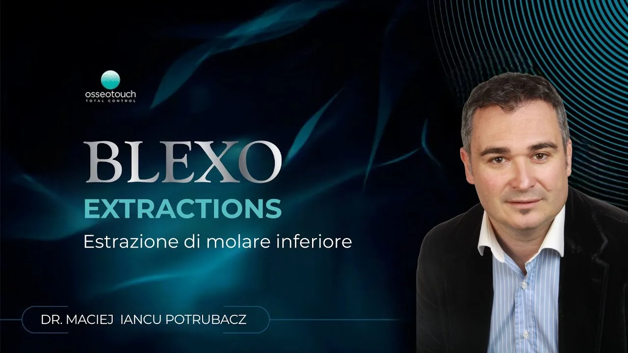 Caso clinico estrazione magnetodinamica 1