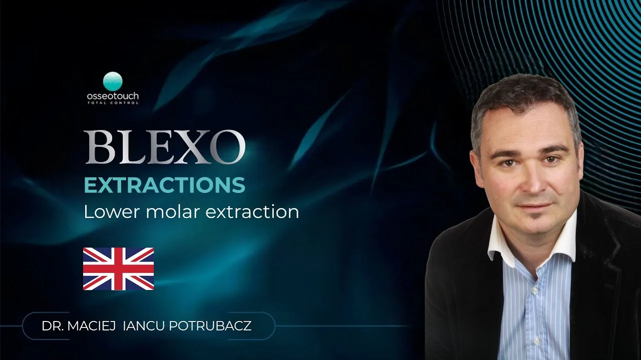 BLEXO clinical case — lower molar extraction